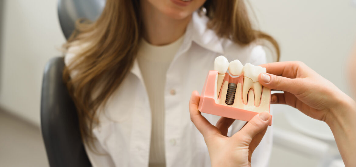 doctor talking to a young woman patient. Discussion of the treatment plan. A dentist shows a model of a dental implant